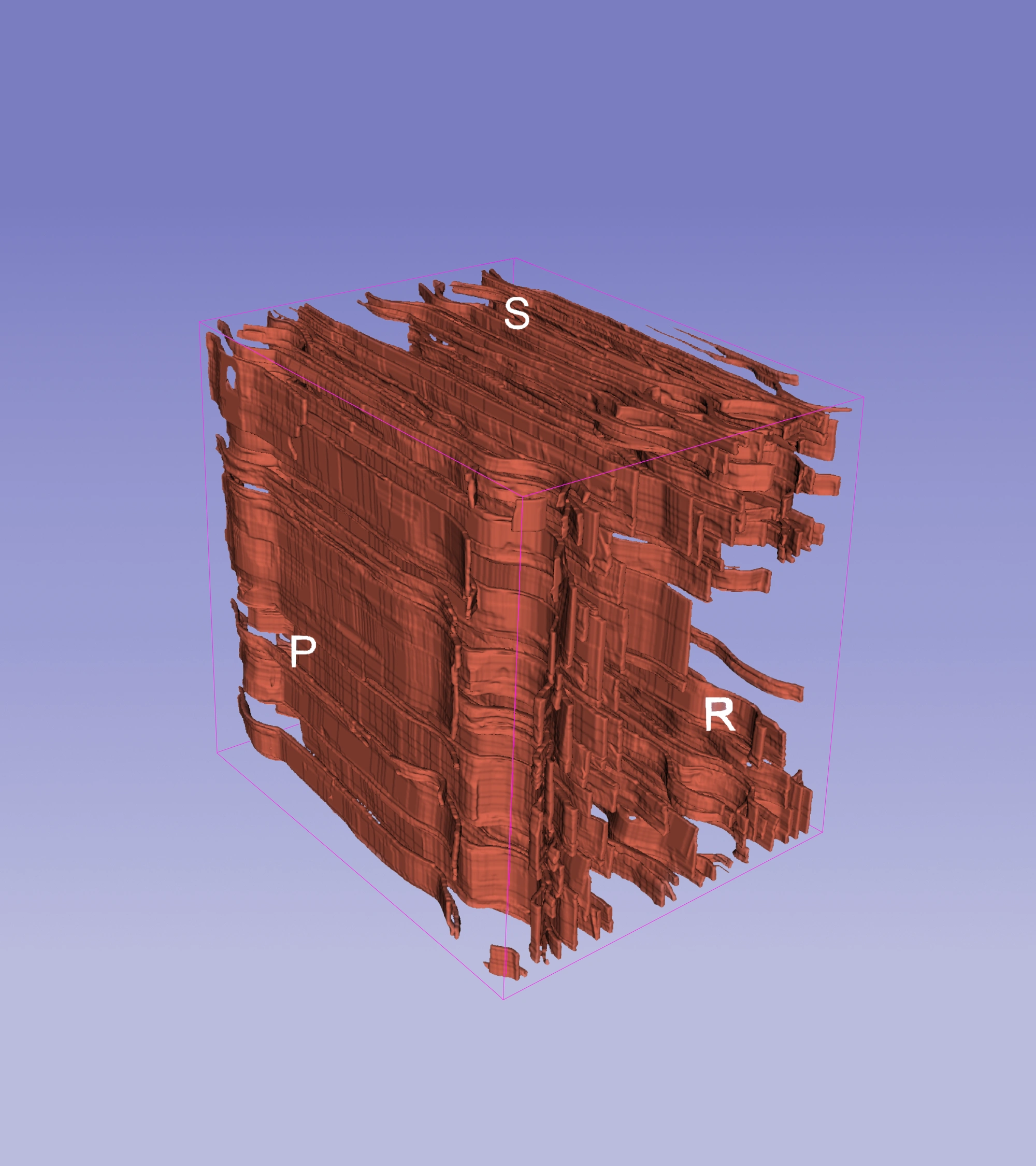 Segmentation of Parenchyma Cells of Oak Wood